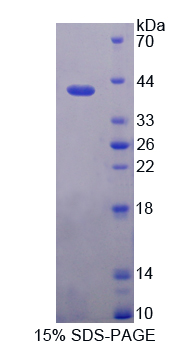 角蛋白6C(KRT6C)重组蛋白,Recombinant Keratin 6C (KRT6C)