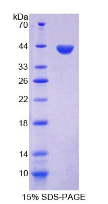 角蛋白33A(KRT33A)重組蛋白,Recombinant Keratin 33A (KRT33A)