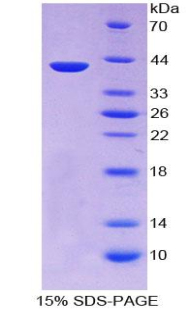 角蛋白3(KRT3)重组蛋白,Recombinant Keratin 3 (KRT3)