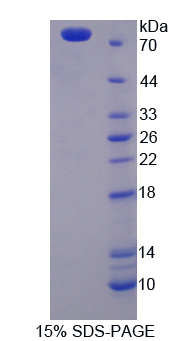 角蛋白28(KRT28)重组蛋白,Recombinant Keratin 28 (KRT28)