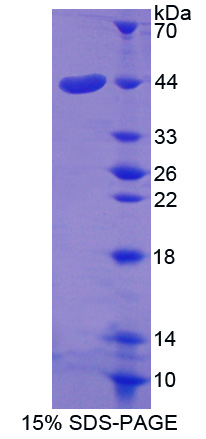 膠質(zhì)細(xì)胞源性連接蛋白(GDN)重組蛋白,Recombinant Glia Derived Nexin (GDN)