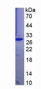 胶乳素(LXN)重组蛋白,Recombinant Latexin (LXN)