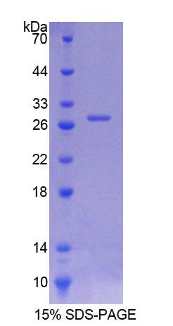 交叉蛋白1(ITSN1)重组蛋白,Recombinant Intersectin 1 (ITSN1)