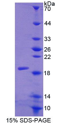 降钙素受体(CTR)重组蛋白,Recombinant Calcitonin Receptor (CTR)