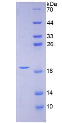 降钙素基因相关肽(CGRP)重组蛋白,Recombinant Calcitonin Gene Related Peptide (CGRP)