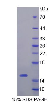 降钙素(CT)重组蛋白,Recombinant Calcitonin (CT)