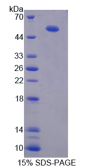 腱蛋白样蛋白1(CHRDL1)重组蛋白,Recombinant Chordin Like Protein 1 (CHRDL1)