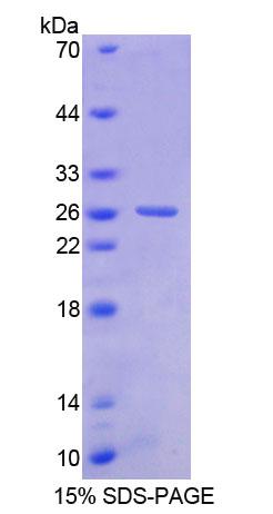 堿核蛋白1(BNC1)重組蛋白,Recombinant Basonuclin 1 (BNC1)