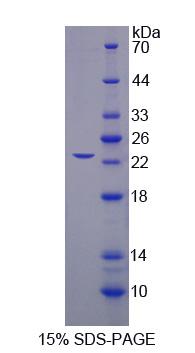 剪接因子3B亚基3(SF3B3)重组蛋白,Recombinant Splicing Factor 3B Subunit 3 (SF3B3)