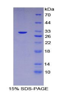 检查点蛋白同源物2(CHEK2)重组蛋白,Recombinant Checkpoint Kinase 2 (CHEK2)