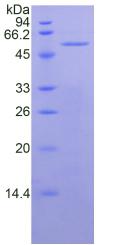 间皮素(MSLN)重组蛋白,Recombinant Mesothelin (MSLN)