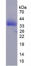 间变性淋巴瘤激酶(ALK)重组蛋白,Recombinant Anaplastic Lymphoma Kinase (ALK)