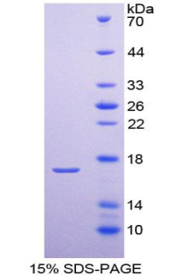 甲状旁腺素受体2(PTHR2)重组蛋白,Recombinant Parathyroid Hormone Receptor 2 (PTHR2)