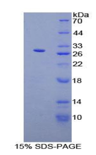 甲状旁腺激素相关蛋白(PTHrP)重组蛋白,Recombinant Parathyroid Hormone Related Protein (PTHrP)