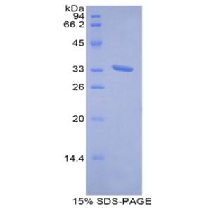 金属硫蛋白1E(MT1E)重组蛋白,Recombinant Metallothionein 1E (MT1E)