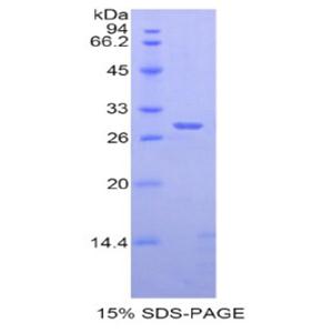 解整合素金属蛋白酶6(ADAM6)重组蛋白