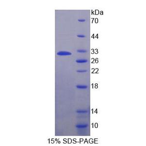 解整合素金屬蛋白酶22(ADAM22)重組蛋白