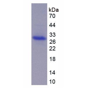 解整合素金属蛋白酶17(ADAM17)重组蛋白