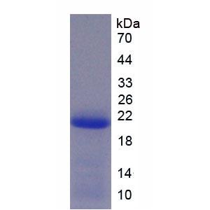 解整合素金属蛋白酶15(ADAM15)重组蛋白