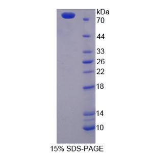 角蛋白28(KRT28)重组蛋白,Recombinant Keratin 28 (KRT28)