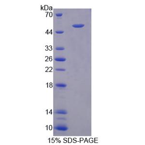 角蛋白25(KRT25)重组蛋白,Recombinant Keratin 25 (KRT25)