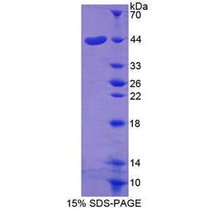 胶质细胞源性连接蛋白(GDN)重组蛋白