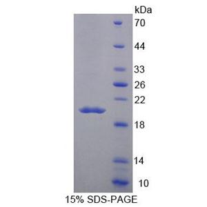 胶原结构巨噬细胞受体(MARCO)重组蛋白,Recombinant Macrophage Receptor With Collagenous Structure (MARCO)