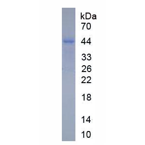 碱性唾液脯氨酸丰富蛋白1(PRB1)重组蛋白