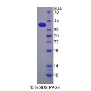 剪切多聚腺苷酸化特异性因子1(CPSF1)重组蛋白,Recombinant Cleavage And Polyadenylation Specific Factor 1 (CPSF1)