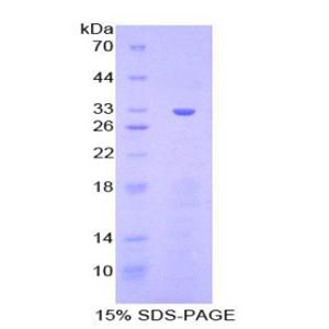 检查点蛋白同源物(CHEK1)重组蛋白,Recombinant Checkpoint Kinase 1 (CHEK1)