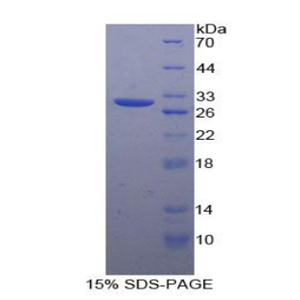 间隙连接蛋白37(CX37)重组蛋白