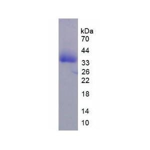 间变性淋巴瘤激酶(ALK)重组蛋白