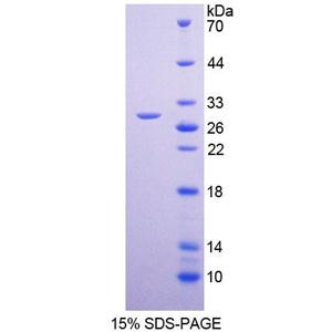 钾氯协同转运蛋白4(KCC4)重组蛋白