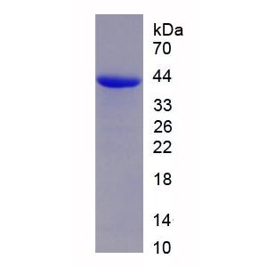 甲状腺转录因子1(TITF1)重组蛋白