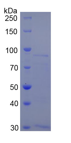 甲硫氨酰氨肽酶2(METAP2)重组蛋白,Recombinant Methionyl Aminopeptidase 2 (METAP2)