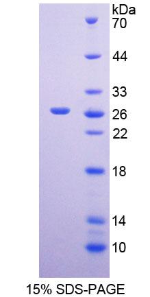 甲硫氨酸亚砜还原酶A(MSRA)重组蛋白,Recombinant Methionine Sulfoxide Reductase A (MSRA)