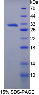 甲基转移酶样蛋白21C(METTL21C)重组蛋白,Recombinant Methyltransferase Like Protein 21C (METTL21C)