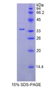 己糖激酶2(HK2)重組蛋白,Recombinant Hexokinase 2 (HK2)