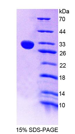 几丁质酶1(CHIT1)重组蛋白,Recombinant Chitinase 1 (CHIT1)