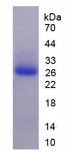 集聚蛋白(AGRN)重组蛋白,Recombinant Agrin (AGRN)