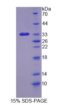 棘皮动物微管关联蛋白样蛋白2(EML2)重组蛋白,Recombinant Echinoderm Microtubule Associated Protein Like Protein 2 (EML2)