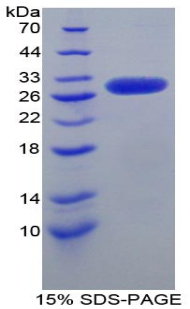 激肽原1(KNG1)重组蛋白,Recombinant Kininogen 1 (KNG1)