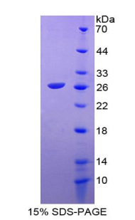 激肽釋放酶原(PK)重組蛋白,Recombinant Prekallikrein (PK)