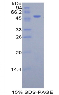 激肽釋放酶7(KLK7)重組蛋白,Recombinant Kallikrein 7 (KLK7)