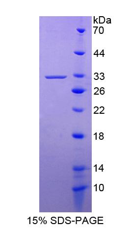 激肽釋放酶13(KLK13)重組蛋白,Recombinant Kallikrein 14 (KLK14)