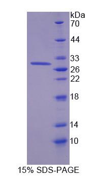 激肽釋放酶12(KLK12)重組蛋白,Recombinant Kallikrein 12 (KLK12)