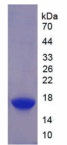 激素敏感性脂肪酶(LIPE)重組蛋白,Recombinant Lipase, Hormone Sensitive (LIPE)