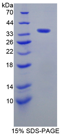 激酶锚定蛋白11(AKAP11)重组蛋白,Recombinant A Kinase Anchor Protein 11 (AKAP11)