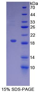 激活素A受体ⅡA(ACVR2A)重组蛋白,Recombinant Activin A Receptor Type II A (ACVR2A)