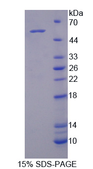 激活素A受体ⅠC(ACVR1C)重组蛋白,Recombinant Activin A Receptor Type I C (ACVR1C)